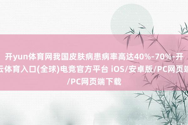 开yun体育网我国皮肤病患病率高达40%-70%-开yun云体育入口(全球)电竞官方平台 iOS/安卓版/PC网页端下载